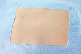 Improve Patient Safety With Disposable Medical Products