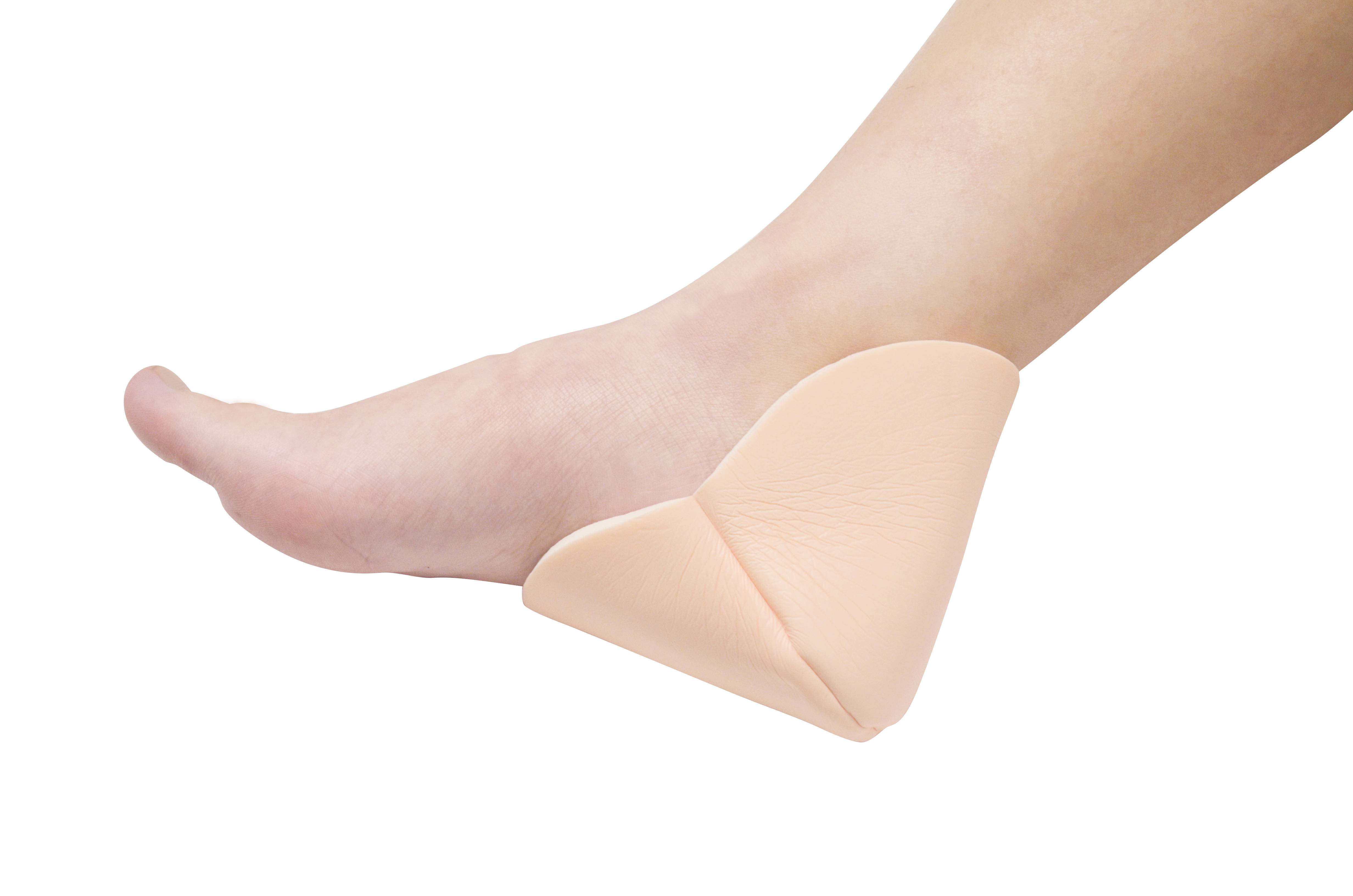 Different Grades of Diabetic Foot Wounds and Related Advanced Wound Dressings