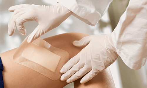 Should I Heal Burns with Dry or Wet Wound Care Products Should I Heal Burns with Dry or Wet Wound Care Products