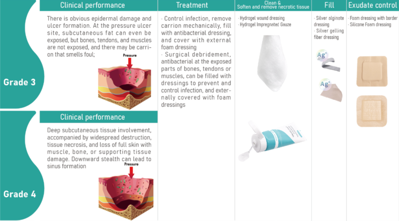 Best Wound Dressings For Pressure Ulcers A Comprehensive Guide Best Wound Dressings For Pressure Ulcers A Comprehensive Guide